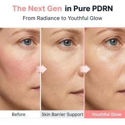 PDRN Pink Vitamin Glow Boosting Ampoule Alle Korean Skincare|Problemlösende Seren