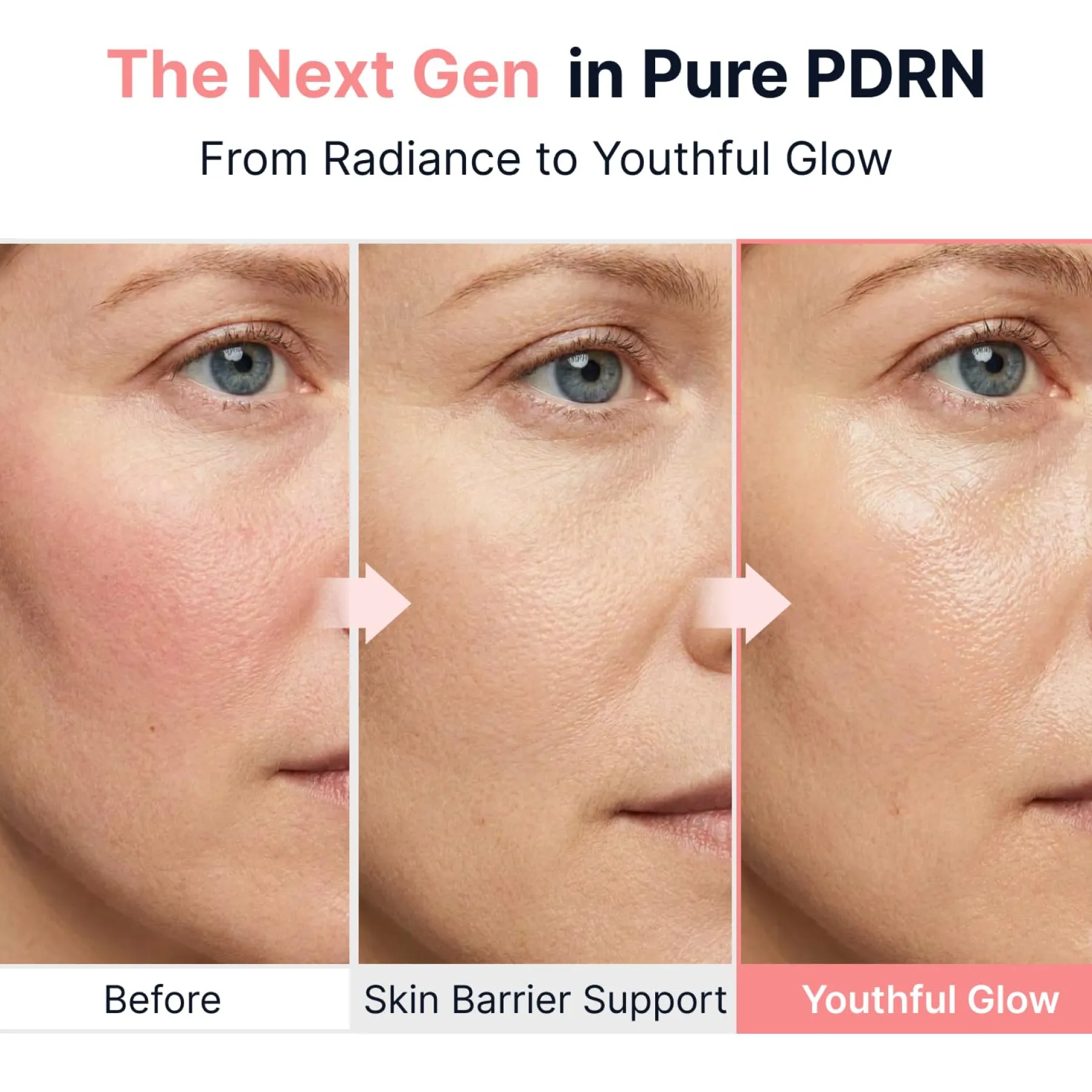 PDRN Pink Vitamin Glow Boosting Ampoule Alle Korean Skincare|Problemlösende Seren