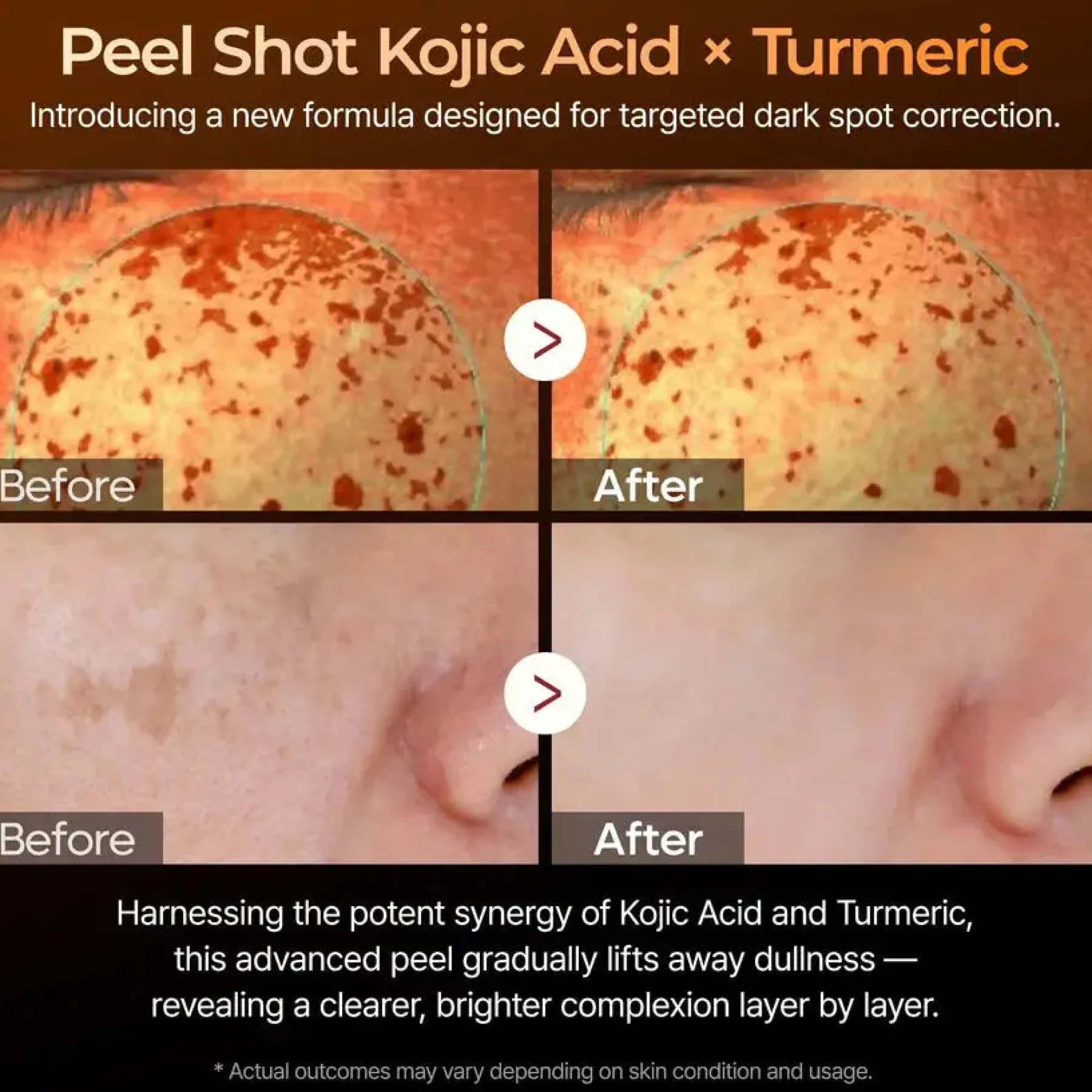 Peel Shot Exfoliating Kojic Acid Turmeric Serum Hauptzutat|Vegan Pflege