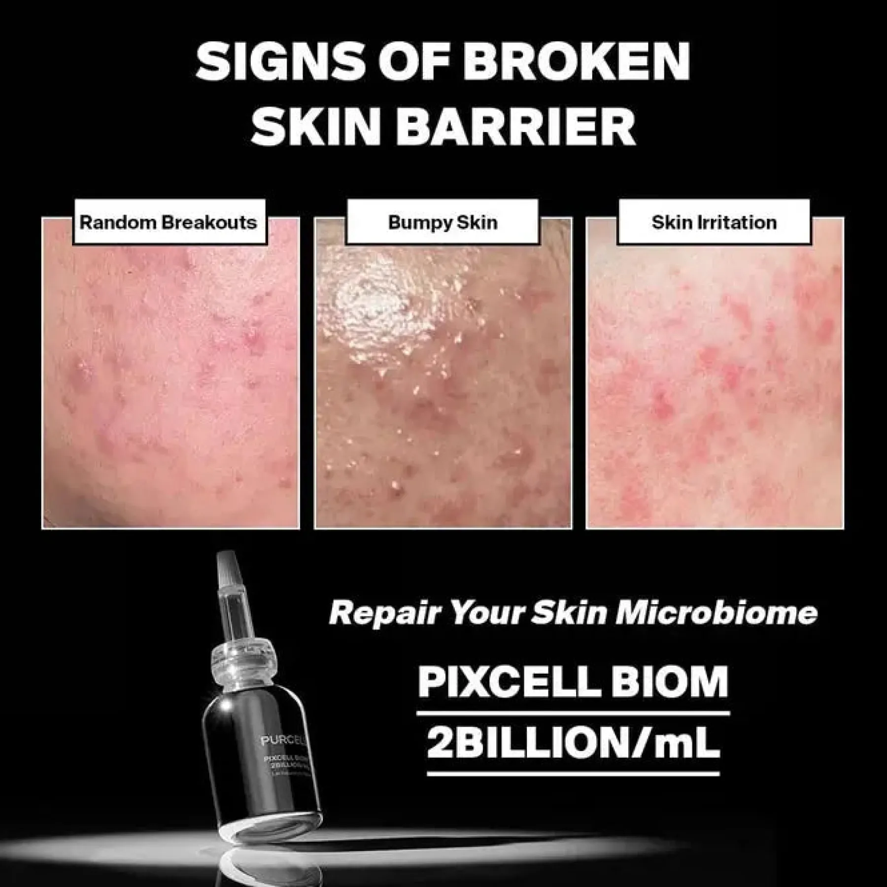 New Pixcell Biom™ 2Billion Anti-Unreinheiten-Serum|Feuchtigkeitsspendendes Serum