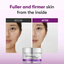 Hot Reedle Shot Lifting Cream Alle Korean Skincare|Feuchtigkeitscremes