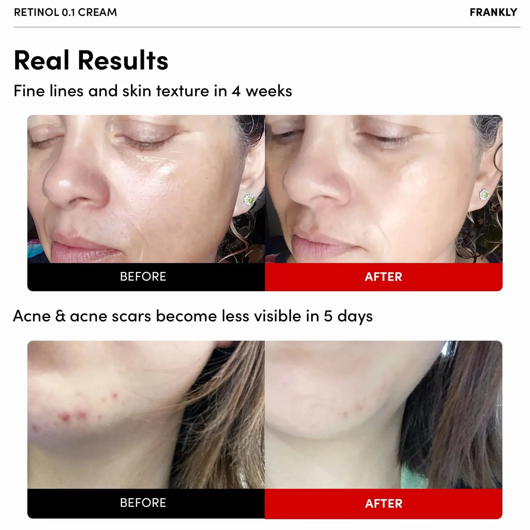New Retinol 0.1% Cream Feuchtigkeitscremes|Hauptzutat