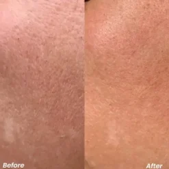 Hot Retinol Pure Night Serum Vegan Pflege|Problemlösende Seren