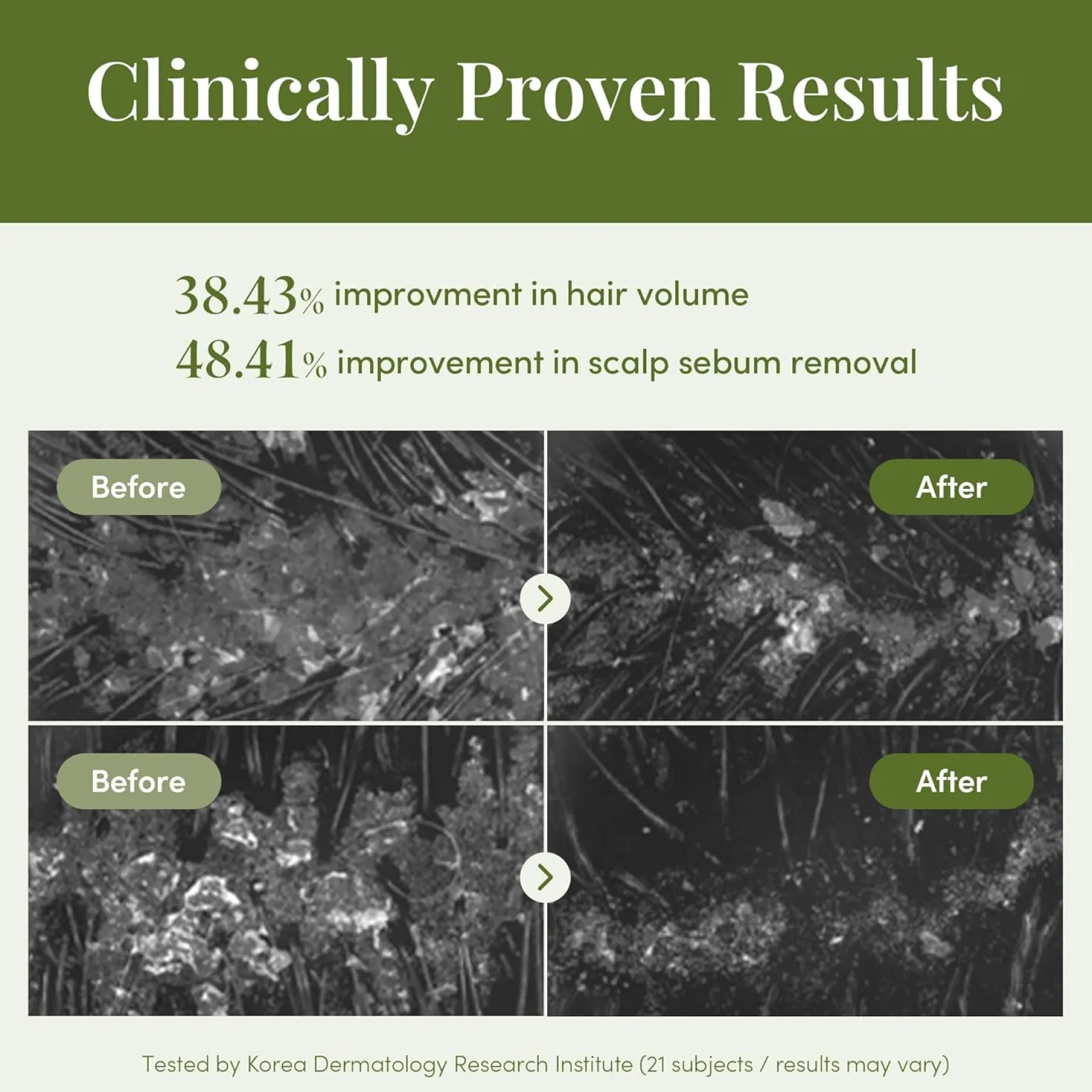 Outlet Revitalizing Treatment Korean Haarpflege|Haarprobleem