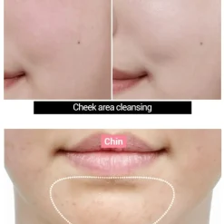 Best Rose Vitamin Brightening Oil Foam Alle Korean Skincare|Hautprobleme