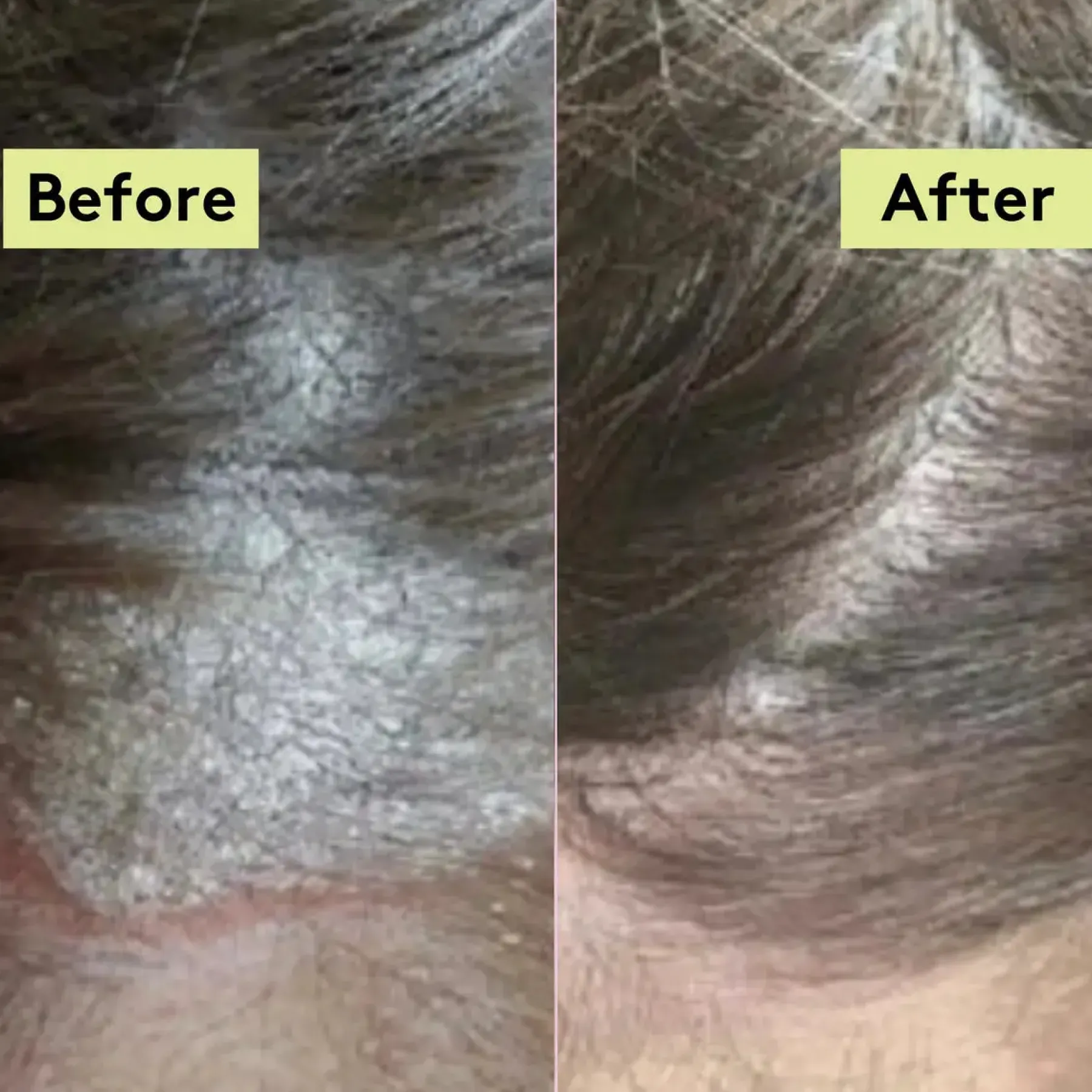 Outlet Scalp-Eaze Scalp Balm Amla Berry & Mango Butter Hair Growth|11 Schritte Haarpflege Routine