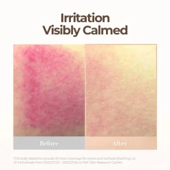 New Skin Blemish Balm Intensive Alle Korean Skincare|Korean Makeup