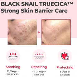 Clearance Snail Truecica Miracle Repair Cream Feuchtigkeitscremes|Hauptzutat