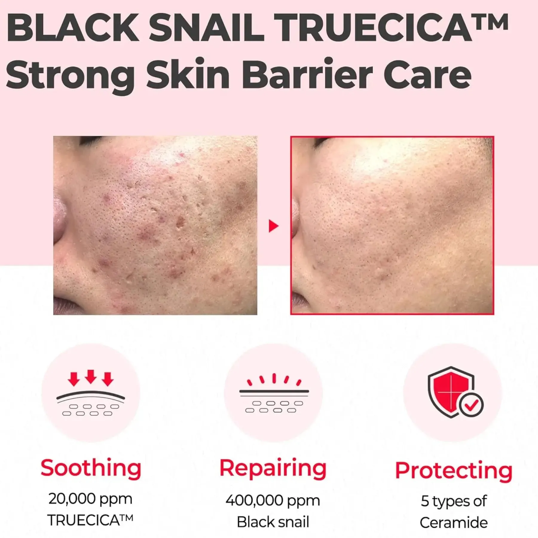 Clearance Snail Truecica Miracle Repair Cream Feuchtigkeitscremes|Hauptzutat
