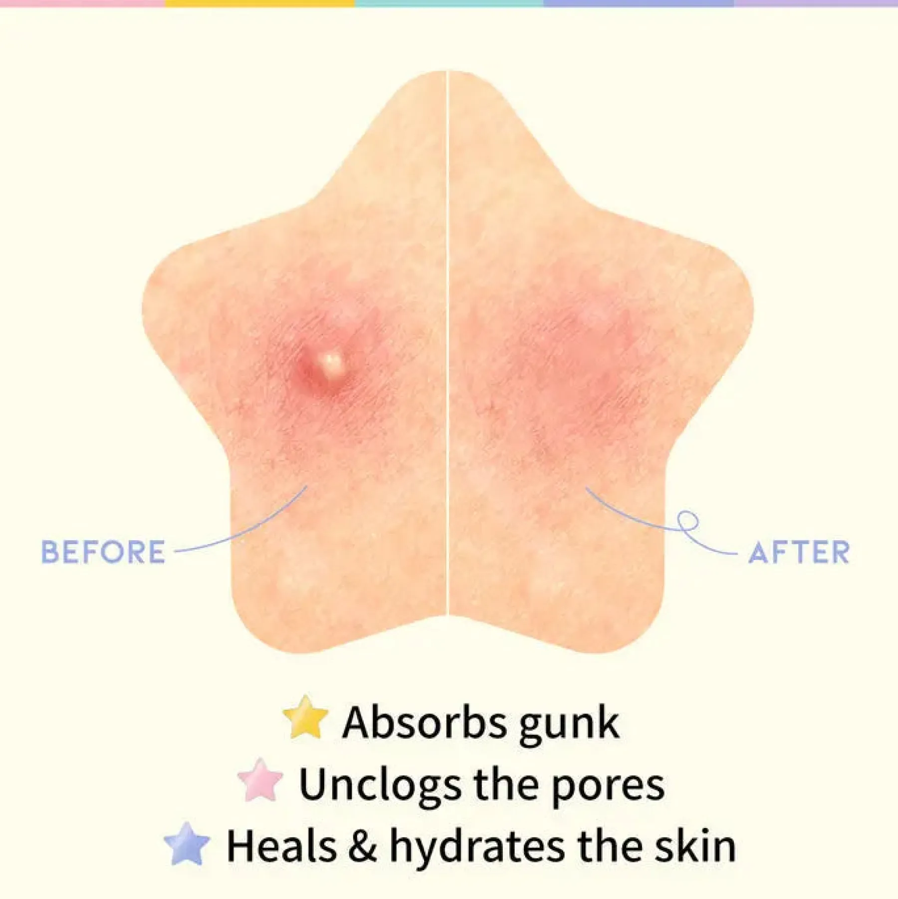 Best Star Spot Patch Hauptzutat|Hautprobleme