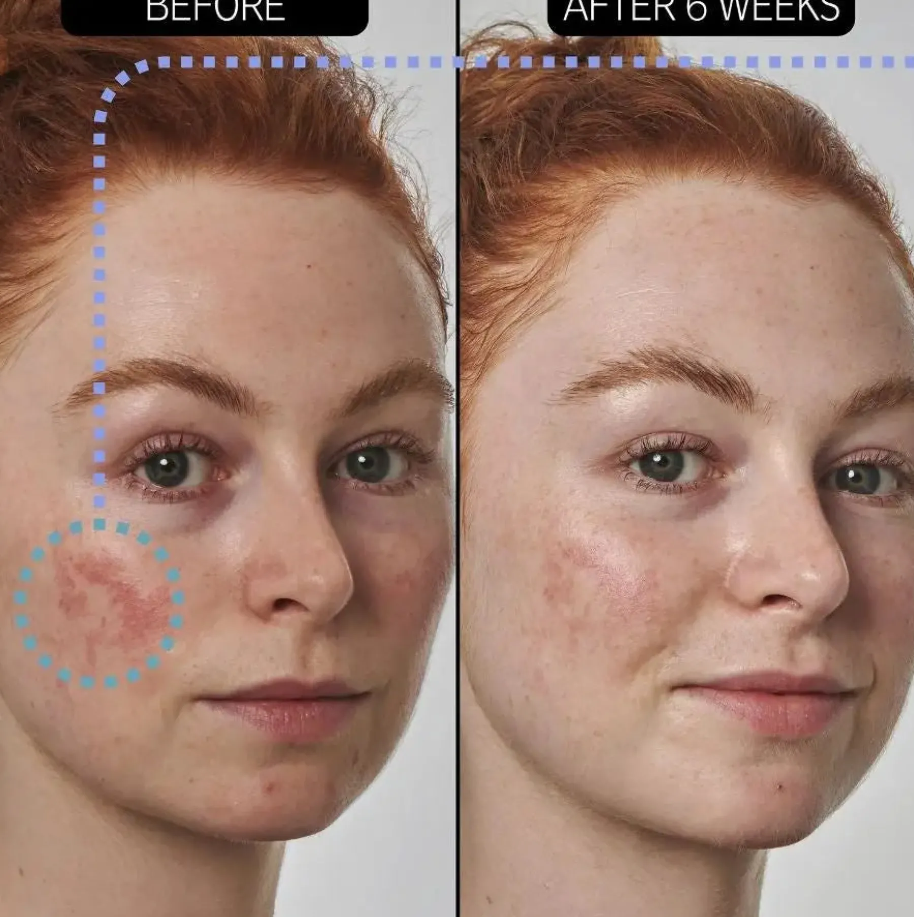 Sale SuperSolutions Redness Relief Solution Vegan Pflege