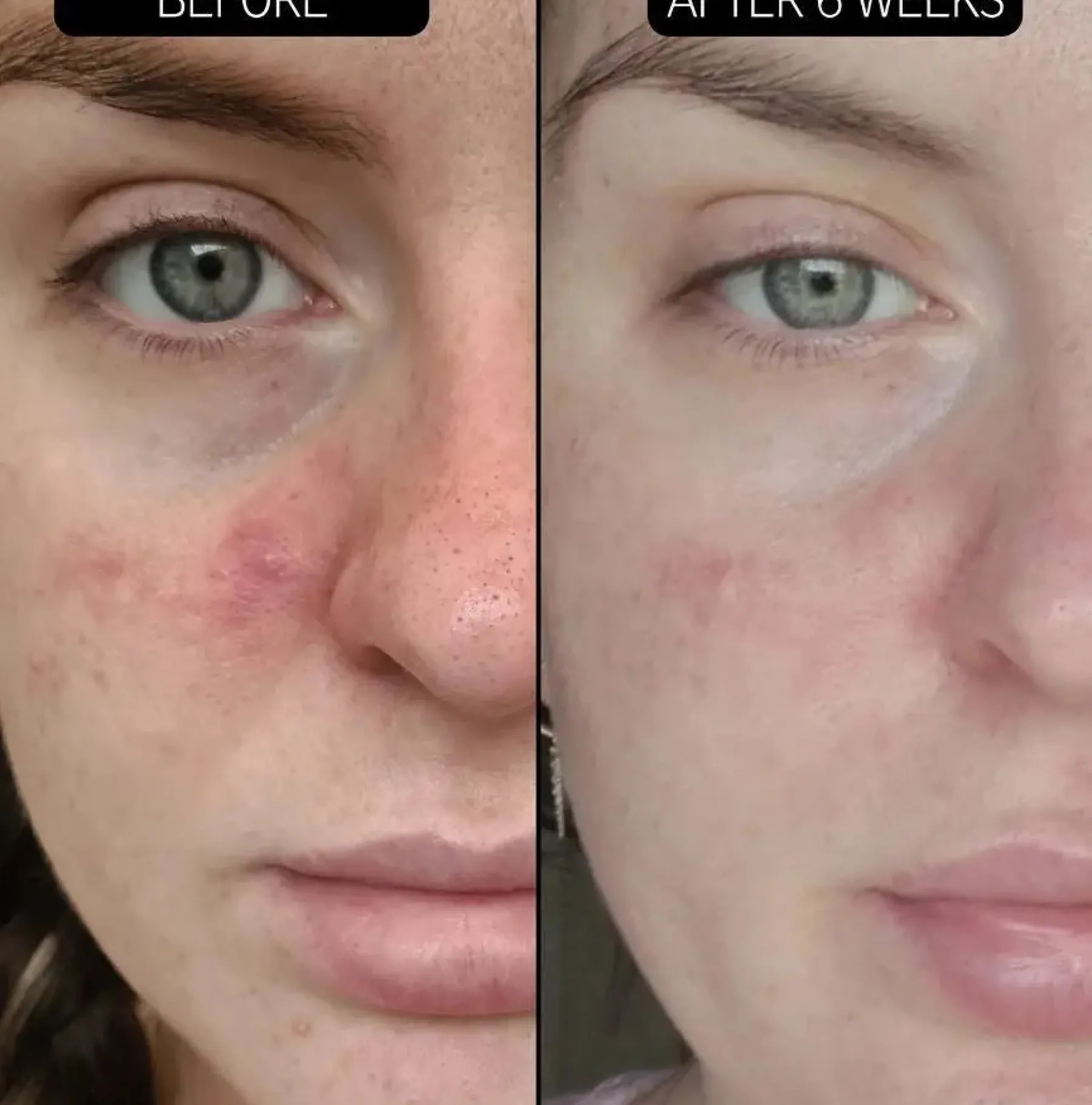 Sale SuperSolutions Redness Relief Solution Vegan Pflege