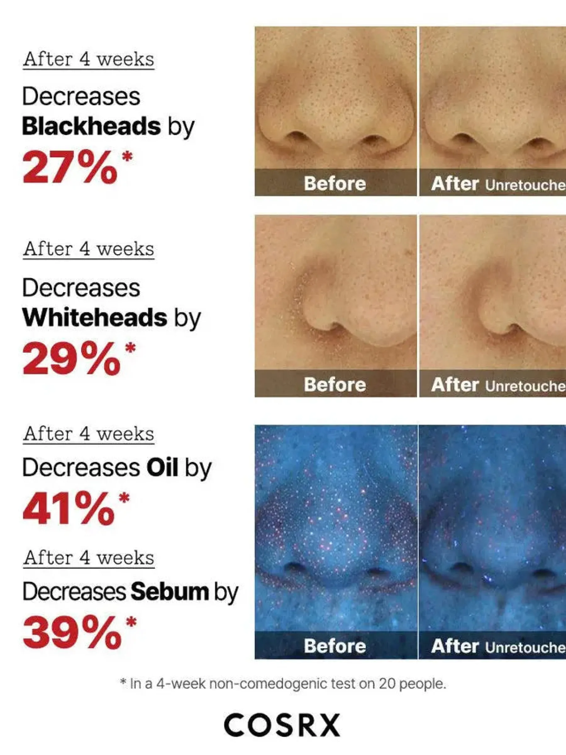 Outlet The AHA 2 BHA 2 Blemish Treatment Serum Hauptzutat|Beruhigendes Serum