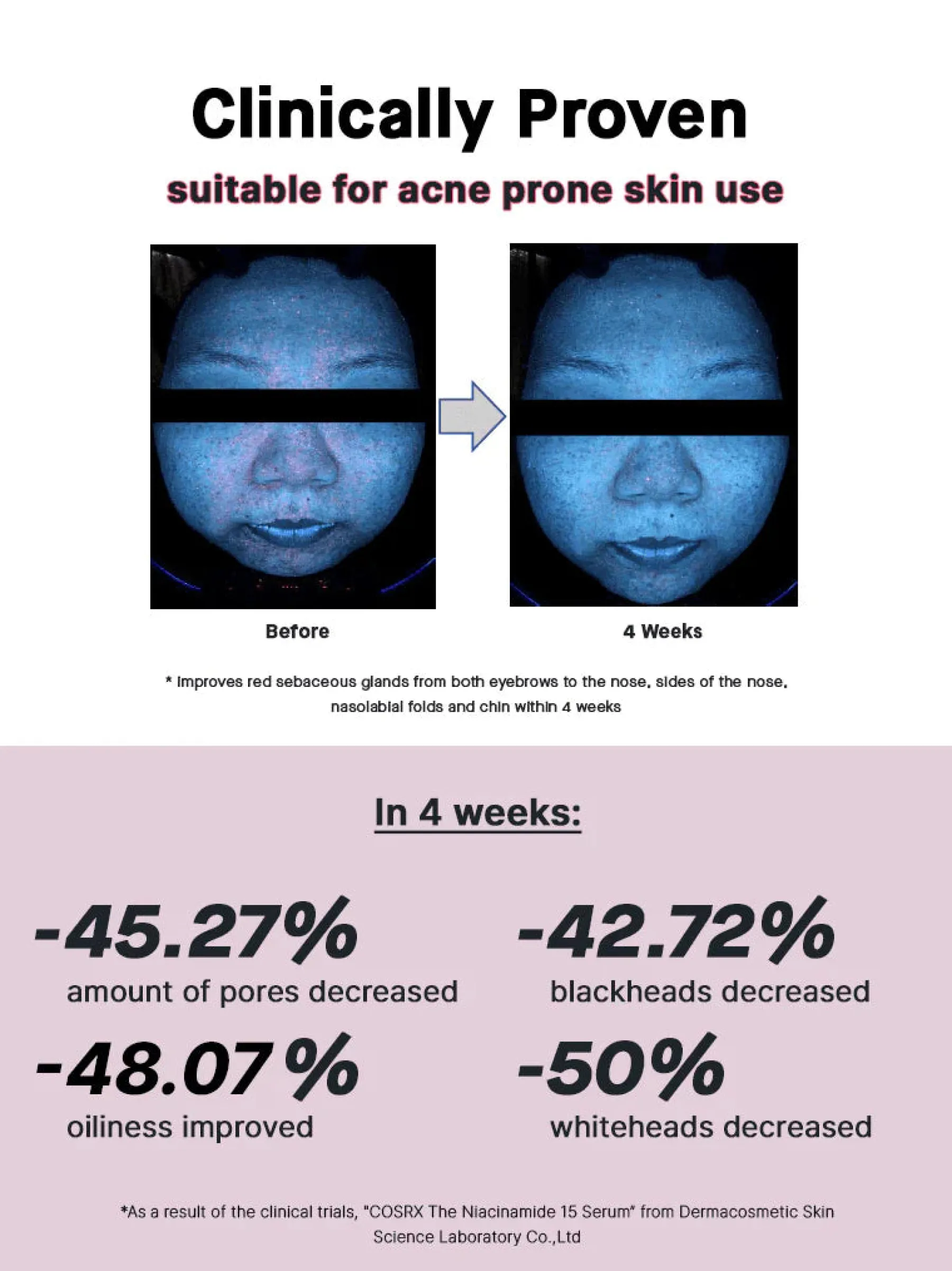 Sale The Niacinamide 15 Serum Hauptzutat|Anti-Unreinheiten-Serum