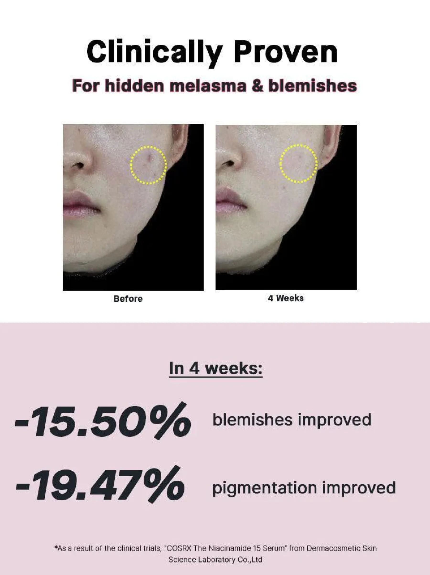 Sale The Niacinamide 15 Serum Hauptzutat|Anti-Unreinheiten-Serum