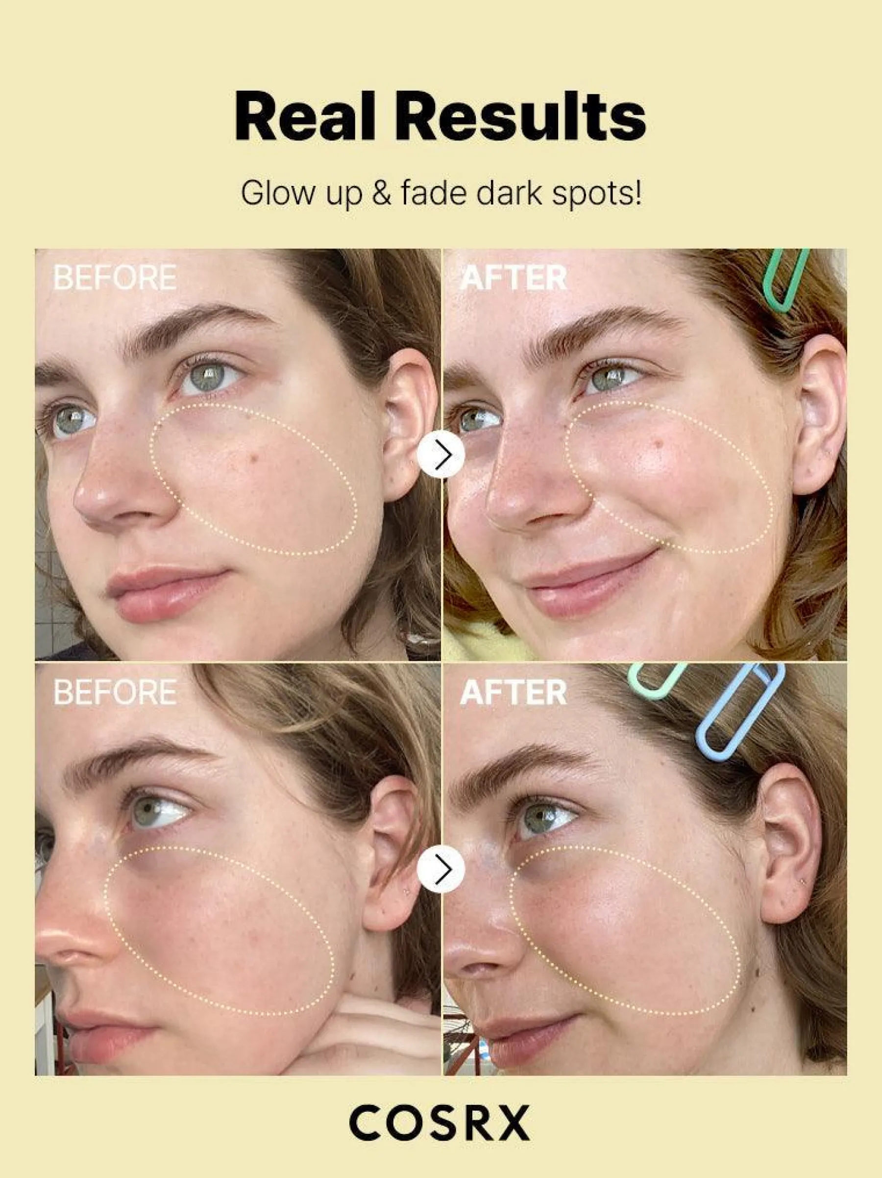 Best The Vitamin C 23 Serum Hauptzutat|Anti-Unreinheiten-Serum