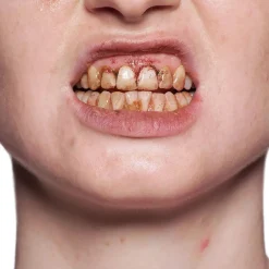 Clearance Tooth Enamel Red Spezialeffekte Make-Up