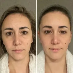 Sale Tripeptide Collagen Kollagen|Hauptzutat