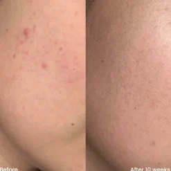 Online Triple AHA Cleanser Vegan Pflege|Hauptzutat