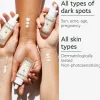 Vinoperfect Radiance Serum Complexion Correcting Problemlösende Seren|Hautprobleme