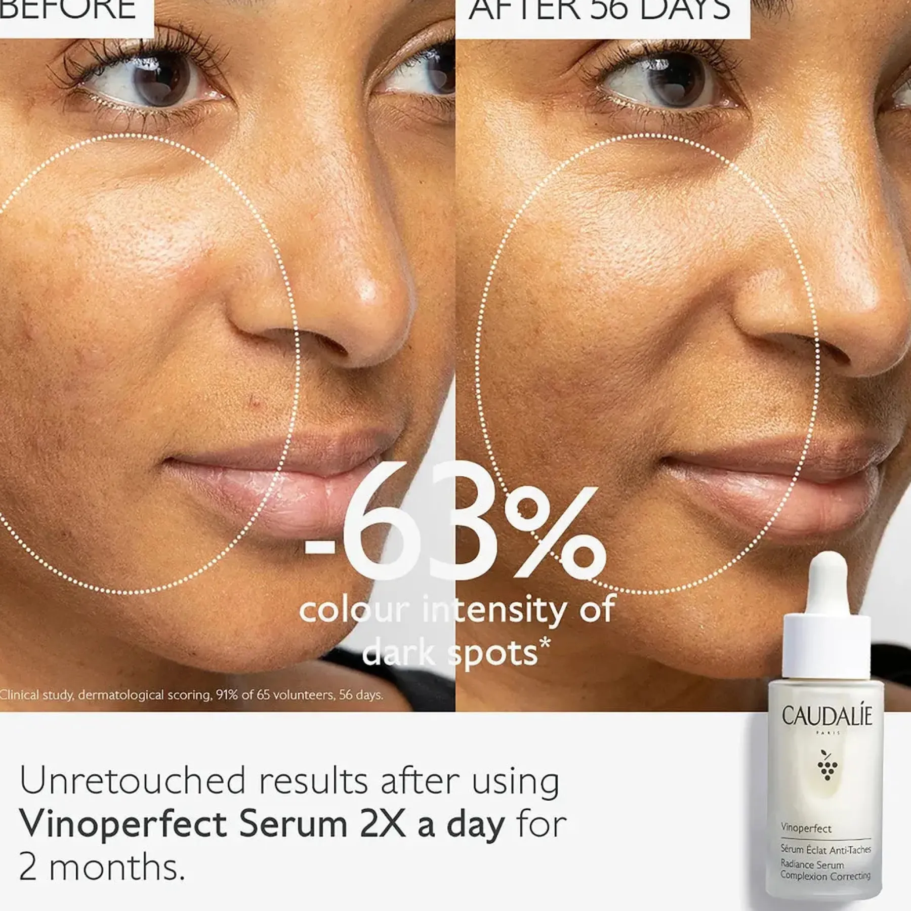Vinoperfect Radiance Serum Complexion Correcting Problemlösende Seren|Hautprobleme