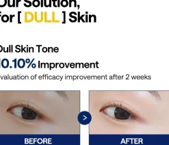 Hot Vitamide Blemish Care Pad Brightening Toners|Toner Pads