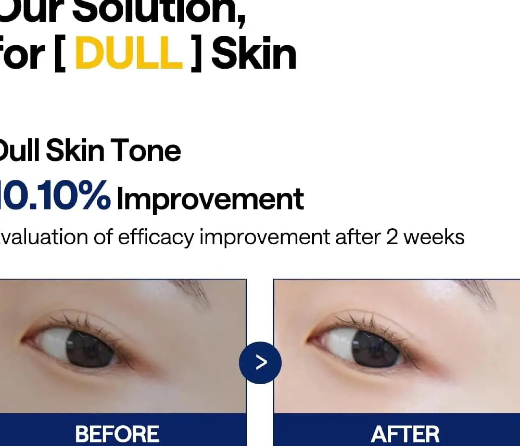 Hot Vitamide Blemish Care Pad Brightening Toners|Toner Pads