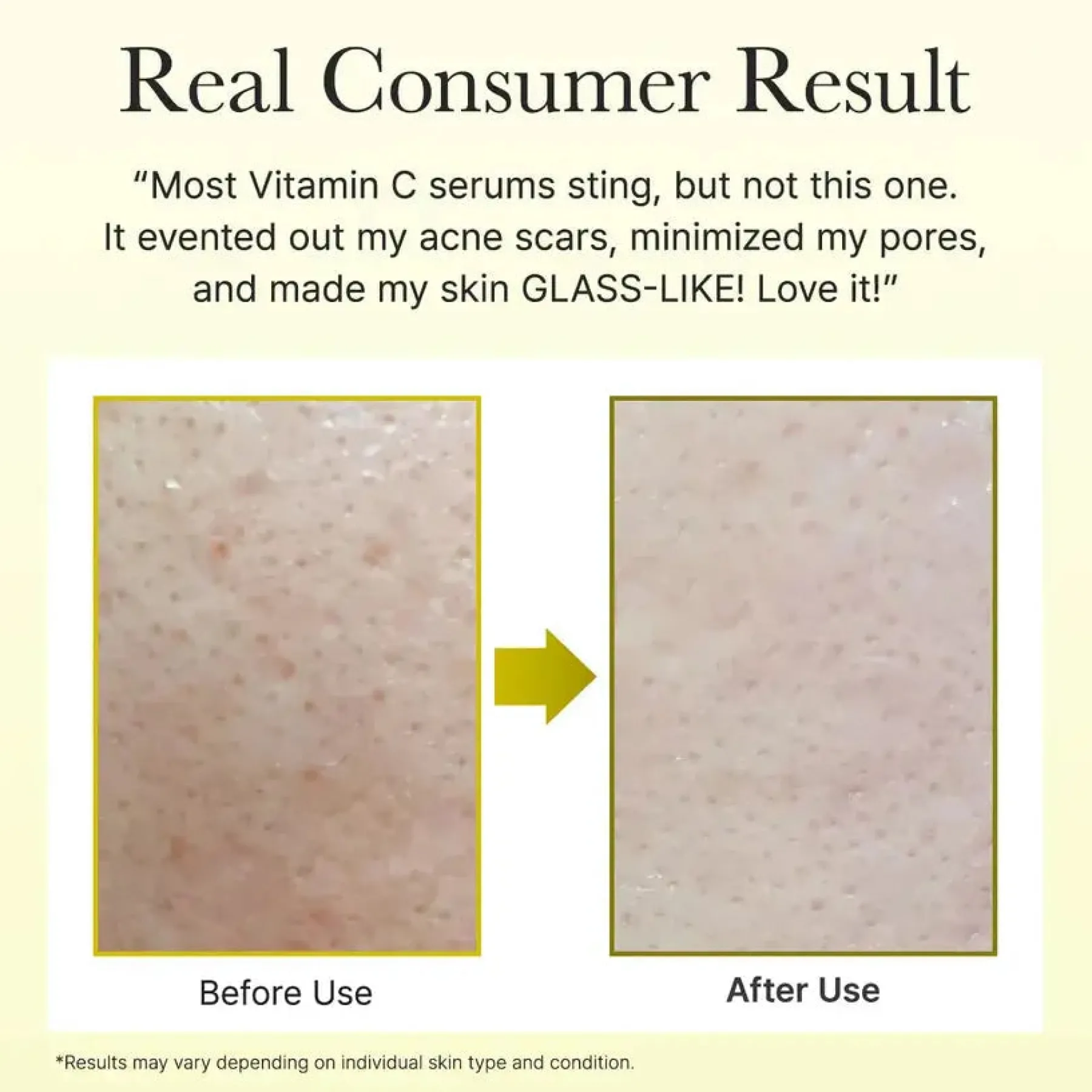 New Vitamin C Booster Shot Mini Anti-Unreinheiten-Serum|Vegan Pflege