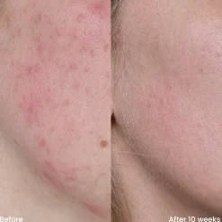 Outlet Vitamine C Serum Vegan Pflege|Problemlösende Seren