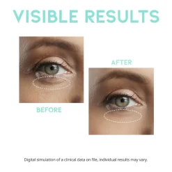 Best Wrinkle Lift Eye Serum Alle Korean Skincare|Augenpflege