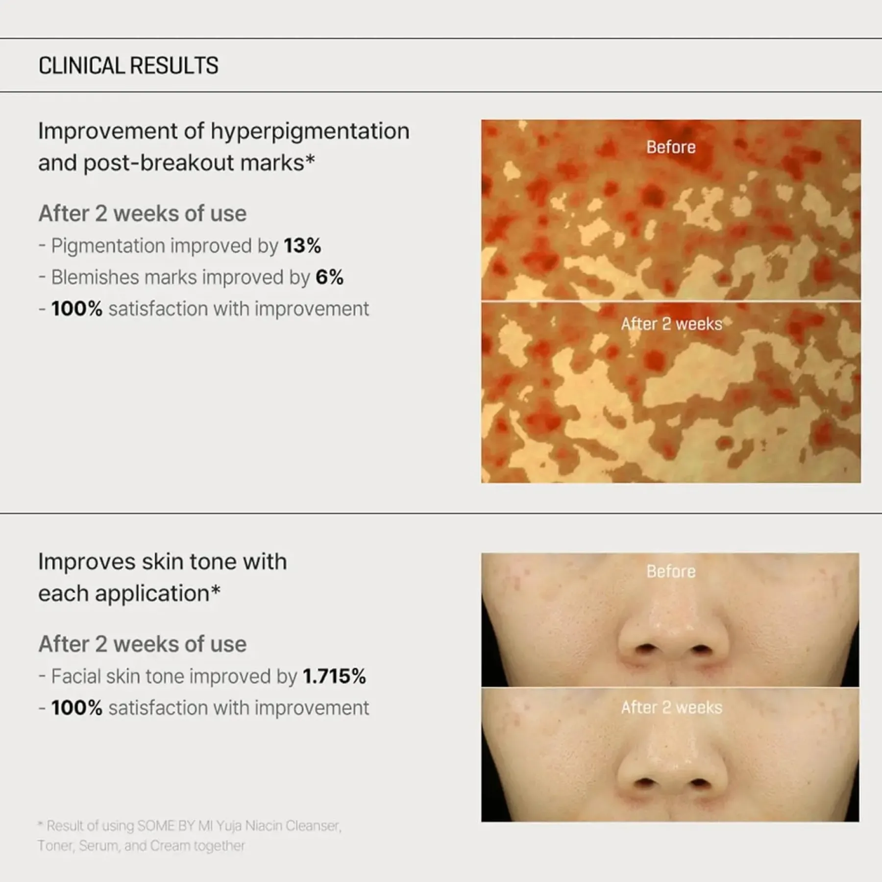 Sale Yuja Niacin Anti-Blemish Cream Feuchtigkeitscremes|Hauptzutat
