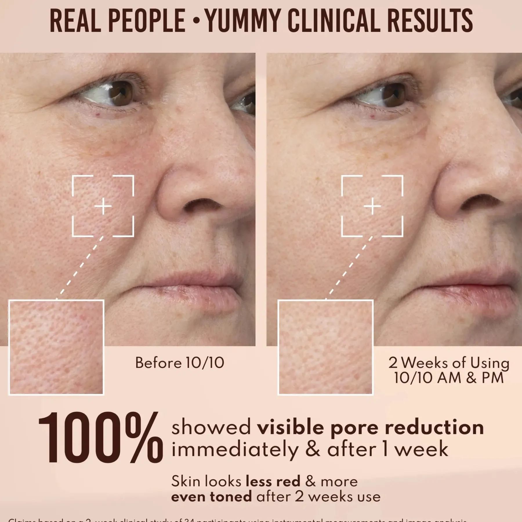 Sale Yummy Skin 10/10 Barrier Boost Vegan Pflege|Problemlösende Seren