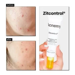 Outlet Zitcontrol Treatment Cream Vegan Pflege